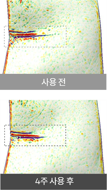 사용 전, 사용 후