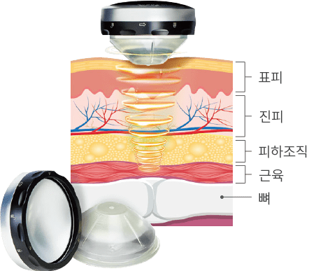 라페라