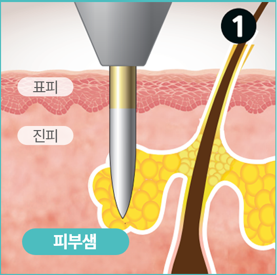 표피, 진피, 피부샘