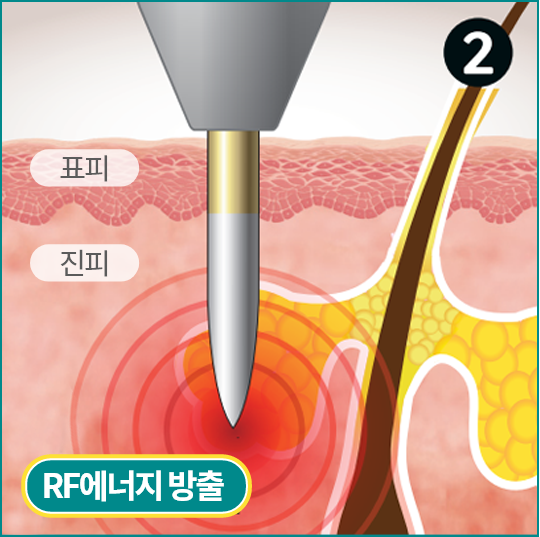 표피, 진피, 피부샘