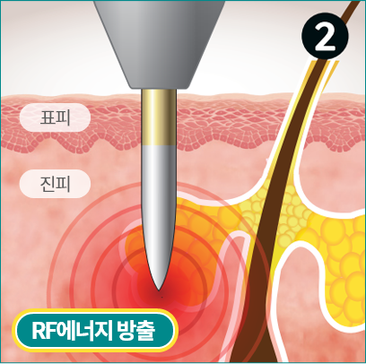 표피, 진피, 피부샘